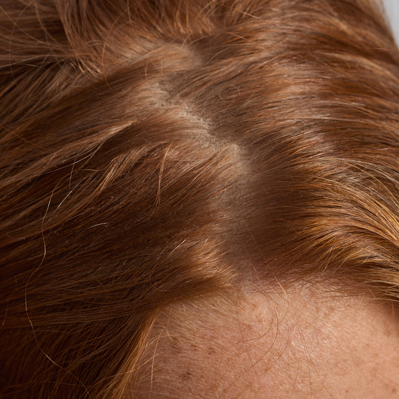 67830-60633-67823-Scalp_HairOilApplicator-Terracotta-Model-Consumables-1-Before-1280x1280px